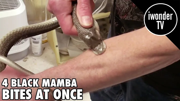 Surviving A Black Mamba Snake Bite - Venom Man - DayDayNews