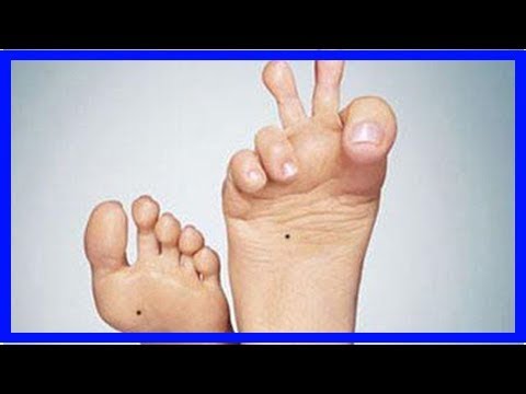 腎臟好或壞，「看腳」就知道