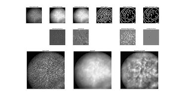 Retinal Video Restoration