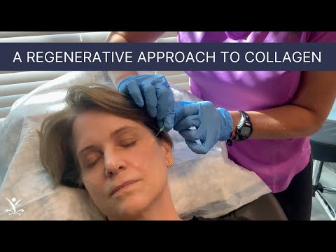 PDO Thread Facelift with Dr. T
