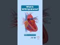 Wolff Parkinson White WPW Syndrome вљЎпёЏрџ Wolff Parkinson White WPW Syndrome вљЎпёЏрџ
