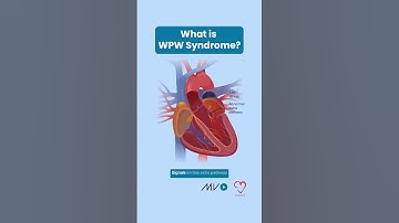 Wolff-Parkinson-White (WPW) Syndrome ⚡️💓