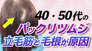 40代・50代の「パックリつむじ」の悩みが急増中！ 今すぐ自分でできる改善方法をアラフォー女性美容師が詳しく解説します！