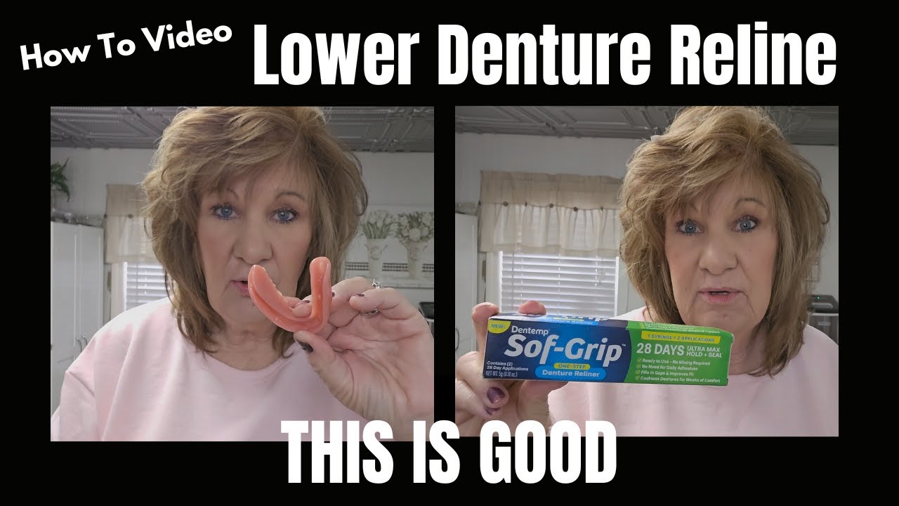 Как правильно перебазировать нижний съемный протез? Набор для перебазировки съемных протезов Sof-...