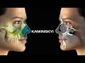 Preparation for a successful rhinoplasty ⭕️ KAMINSKYI