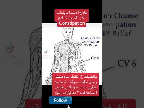 علاج الامساك بنقاط الابر الصينية