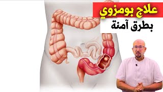 علاج بومزوي أو القولون العصبي طبيعيا الدكتور عماد ميزاب Docteur Imad Mizab