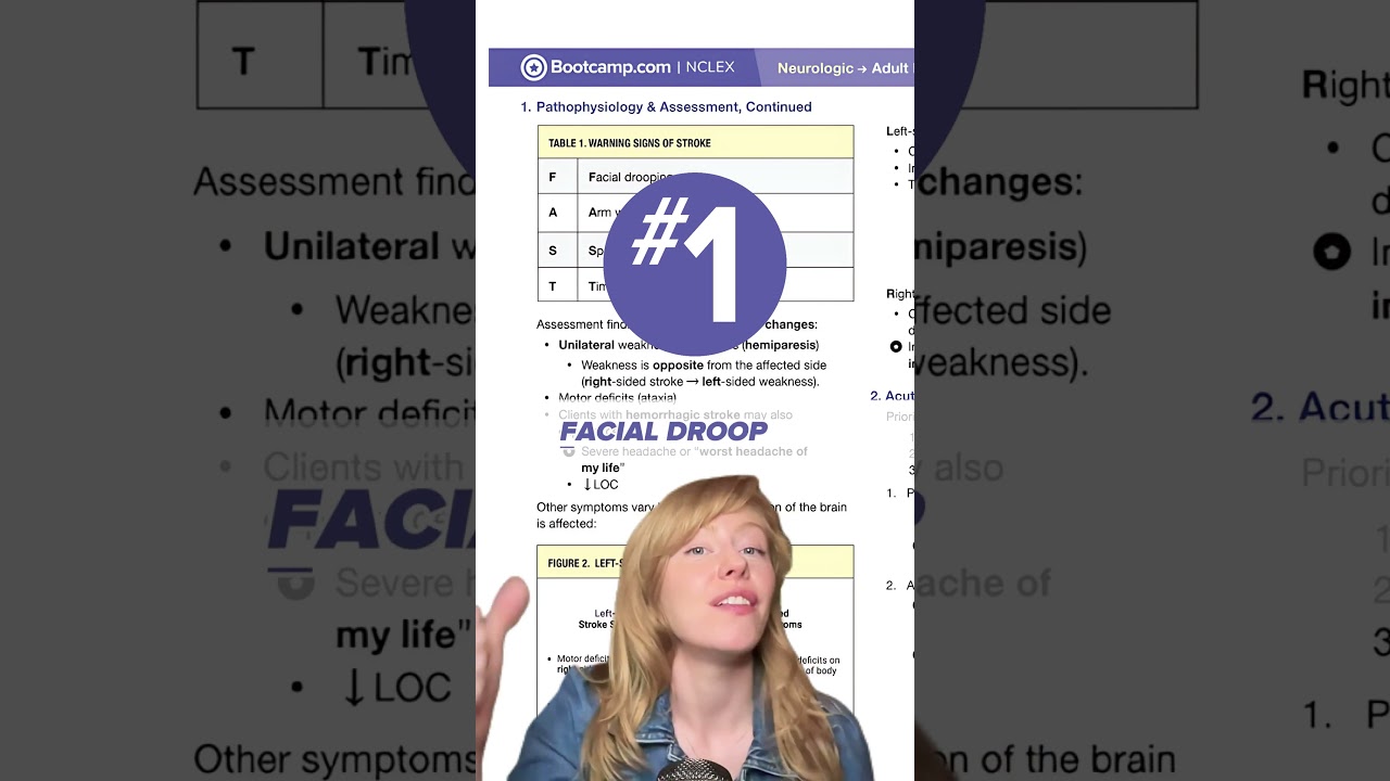 Left vs right-sided stroke NCLEX breakdown🧐 