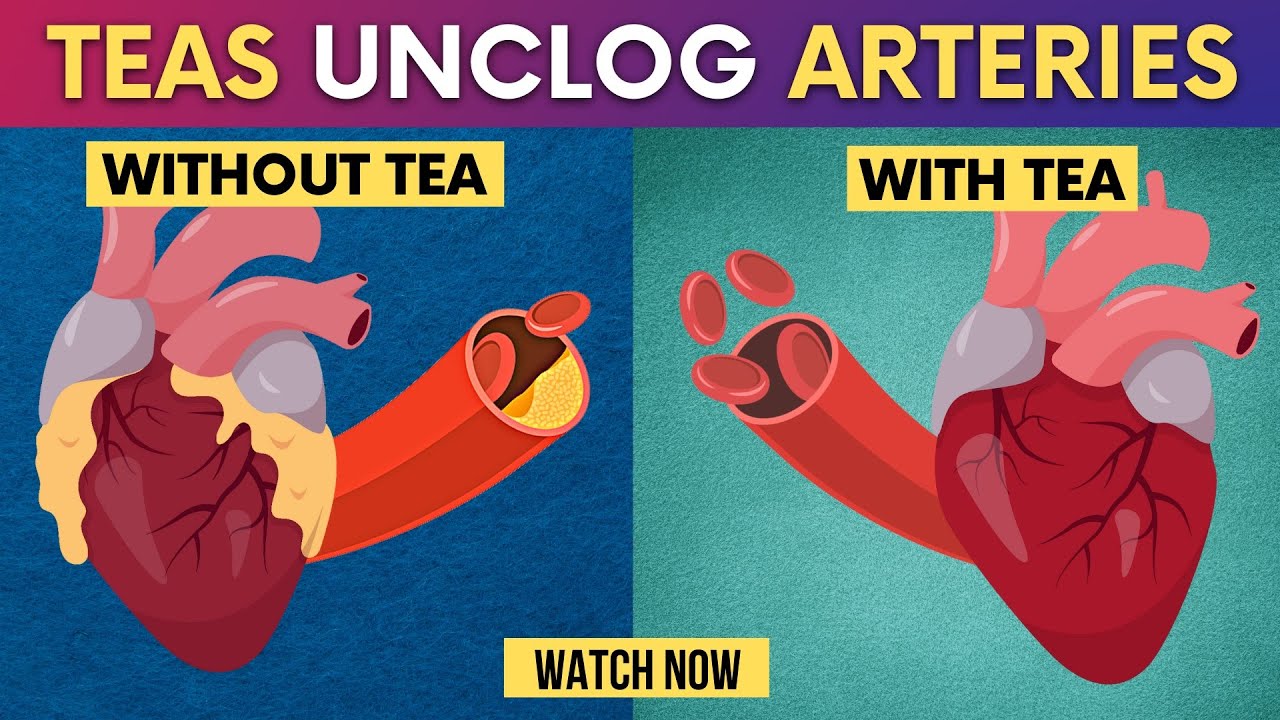 Just 4 Teas Clean your arteries, Lower High Blood pressure And Prevent