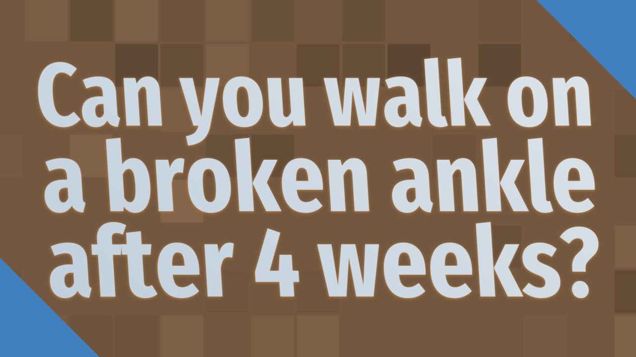 Can You Walk On A Broken Ankle After 4 Weeks YouTube