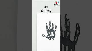 X for X-Ray 🩻 Easy Alphabet handprint art👩‍🎨 #alphabet #montessoriathome #activity #shorts ​⁠