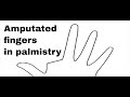 Amputated Fingers in Palmistry