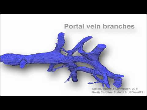 3D Reconstruction of a Canine Liver Portal Tract II