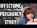 MY ECTOPIC PREGNANCY STORY | NHAANE'S VLOG