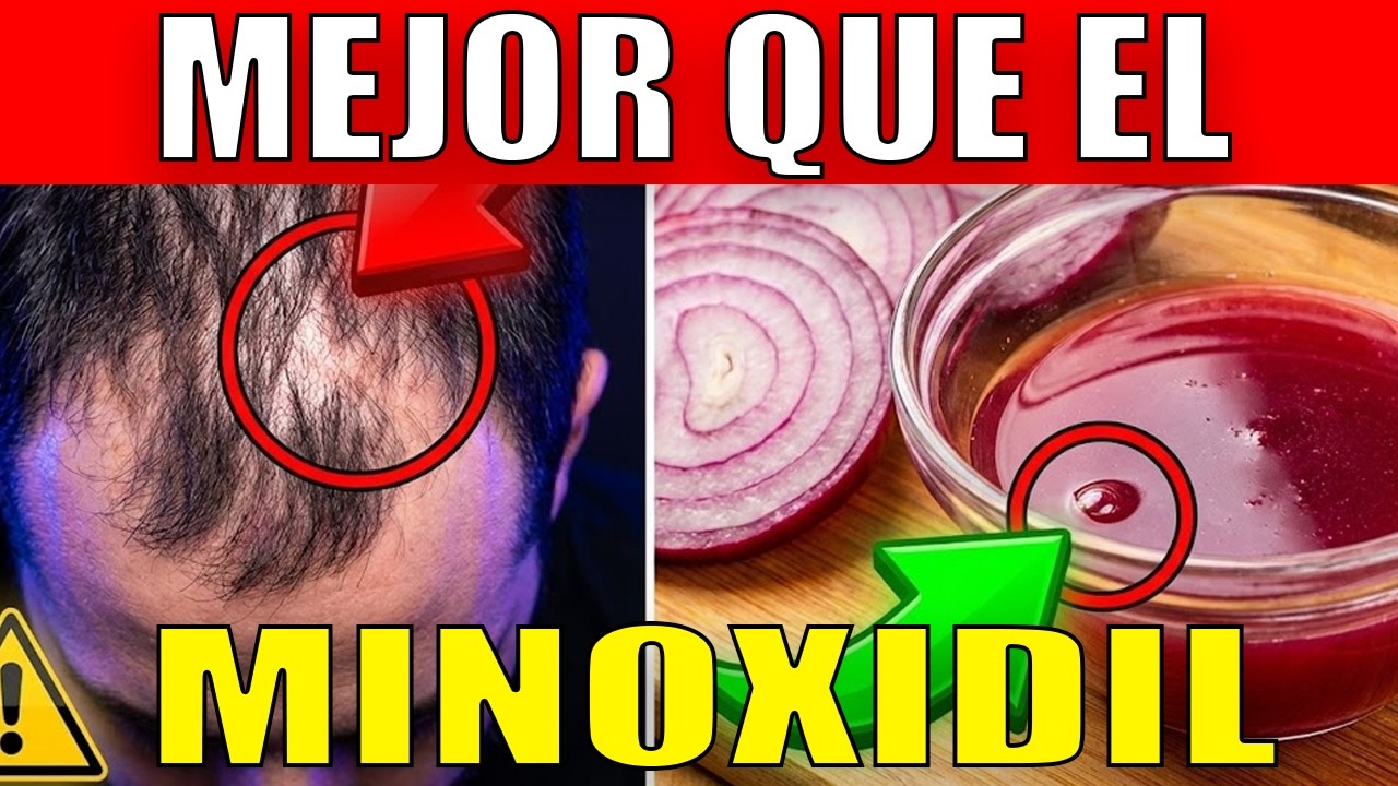 ¡Milagro de $1! Esto hace crecer tu cabello más rápido que el Minoxidil (Científico)
