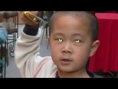 Vídeo: Un Niño Con Ojos De Gato - Vista Alternativa