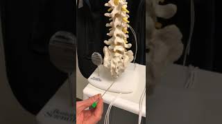 Sacroiliac Joint Injection