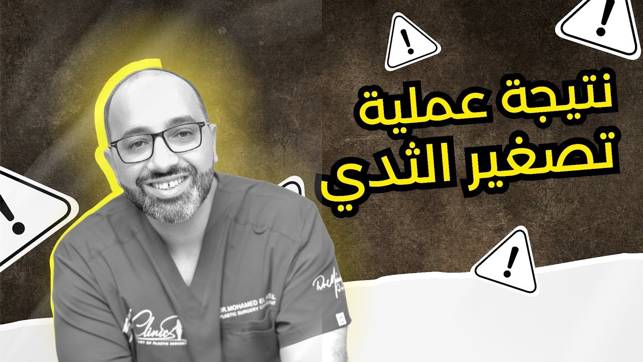 تصغير ورفع الثدي | شوفوا الفرق بعد 15 يوم بنفس الـT-Shirt! 🔥 قبل/بعد مع د. محمد العسال