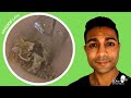 1,414 - Extreme Pruritus Dead Skin Keratin Removal | Read BSHAA Reply