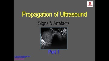 Propagation of Ultrasound - Signs & Artifacts
