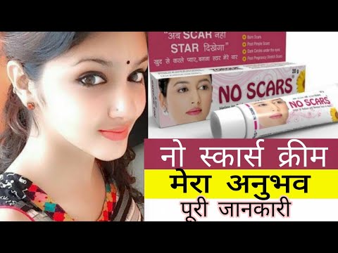 No Scars Cream Remove| Face pigmentation| Melasma | Acne & Pimples Marks | Review In Hindi