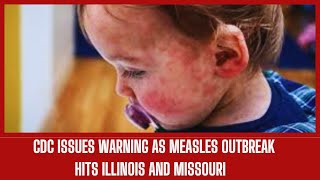 CDC Issues Warning as Measles Outbreak Hits Illinois and Missouri