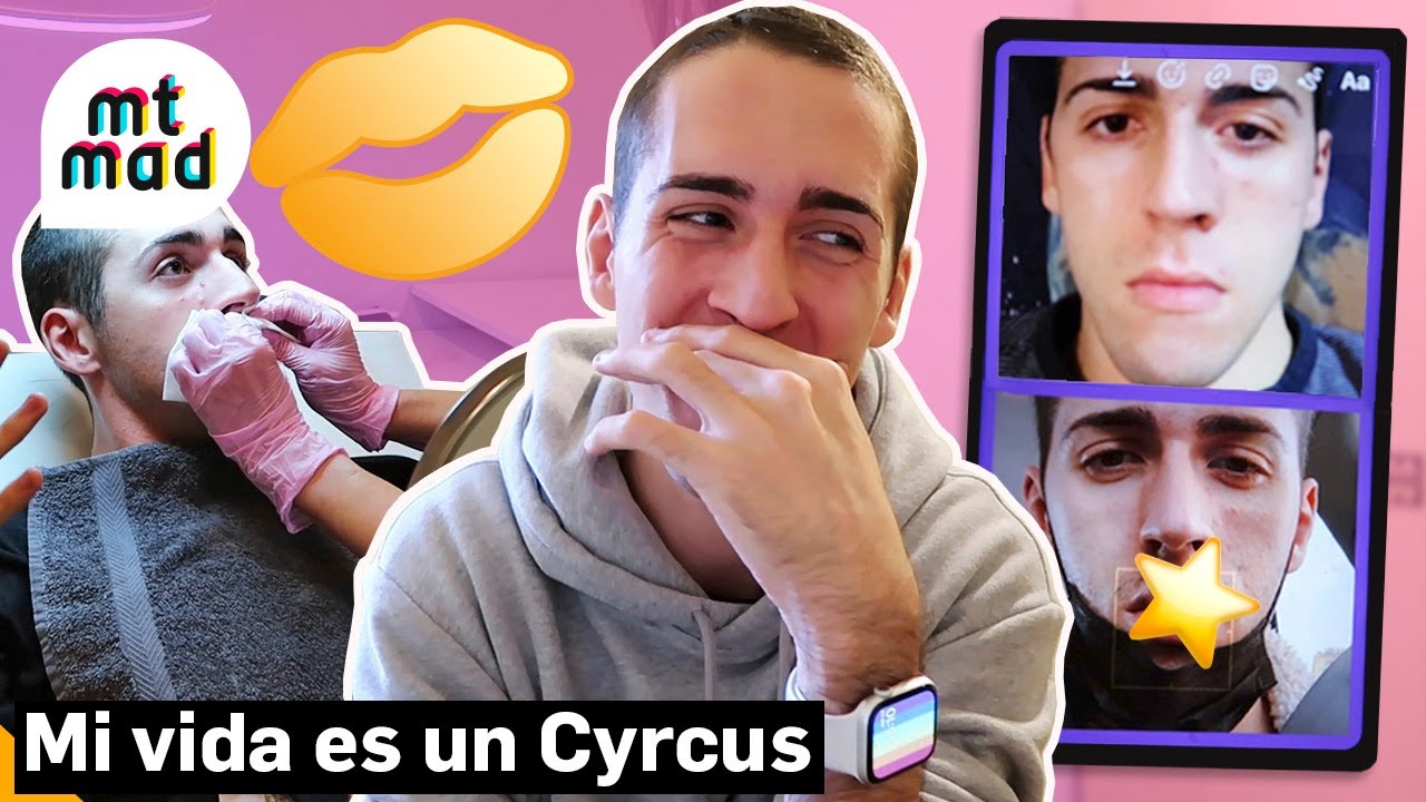 Jorge Cyrus se retoca los labios por primera vez y enseña el espectacular resultado | mtmad