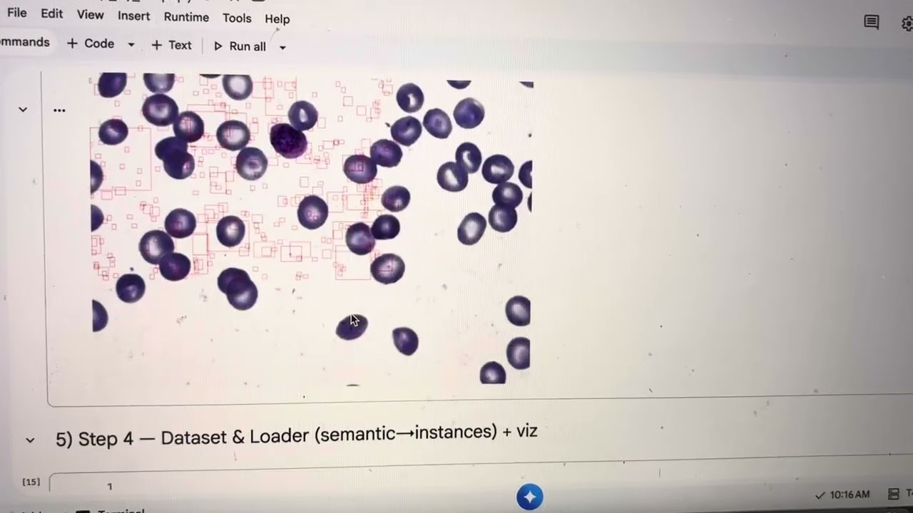 CS50 Final Project — Blood Cell Detection and Segmentation | Zongmei Gao (2025)