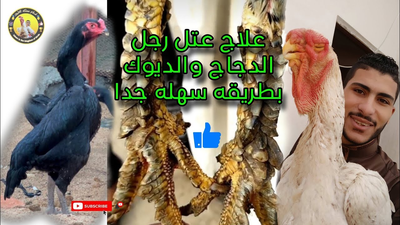علاج عتل رجل الدجاج بطريقه سهله جدا 🤙