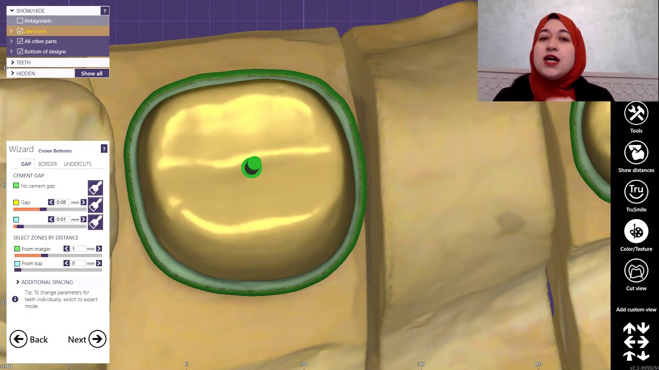 secrets of exocad design software (Arabic)