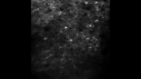 Neurons firing in the brain of a mouse | UCLA Health Newsroom