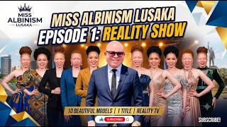 Miss Albinism Lusaka EPISODE 1