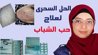 إزاى إتخلصت من حب الشباب وأثاره بالتفصيل والأسعار( نت لوك+أيزوتريتينوين)