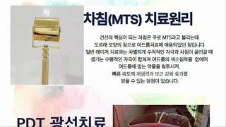 수원건선 한방요법으로 재발 없이