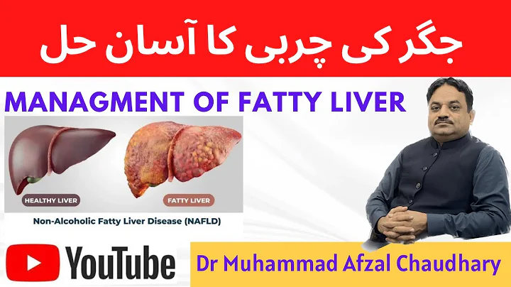 Fatty liver| Management of Fatty Liver |