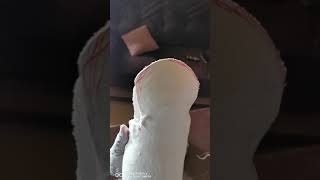 Below knee prosthetic casting
