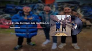 Ben Fero & Khontkar - Heyecanlanman Normal (Caner Karakaş Remix) Resimi