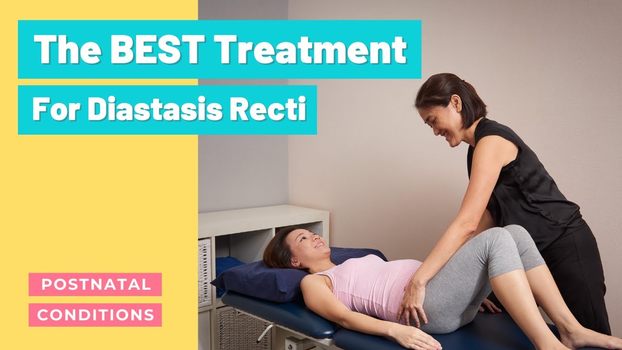 Physical Therapy for Postpartum Diastasis Recti-Mangiarelli