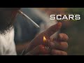 Hard Target & Wess Nyle - Scars (Official Music Video)