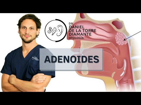 Video: ¿Por qué tenemos adenoides?