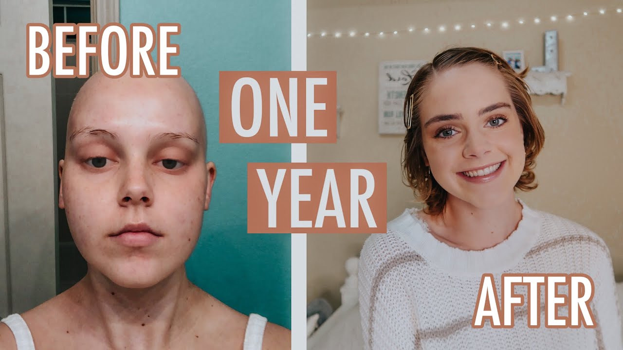 ONE YEAR POST CHEMO HAIR GROWTH | Lauren Mae - YouTube