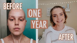 ONE YEAR POST CHEMO HAIR GROWTH | Lauren Mae