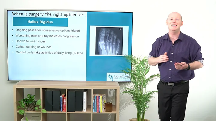Expert Advice on When to Consider Surgery || for Hallux Rigidus