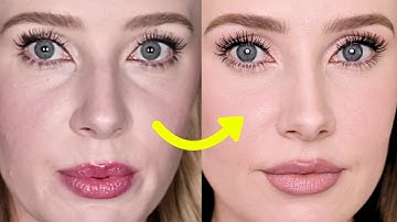 Why I Chose Plastic Surgery Over Filler (And Don’t Regret It)