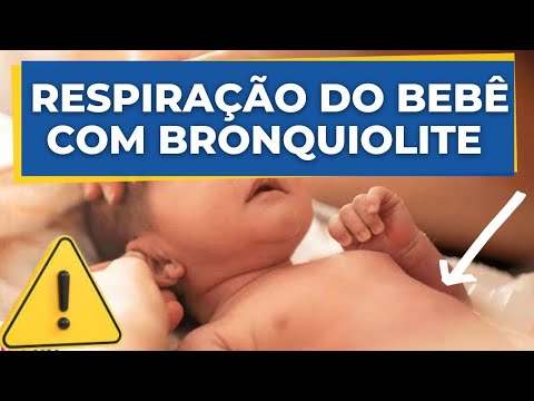 RESPIRAÇÃO DO BEBÊ COM BRONQUIOLITE I EMERGÊNCIA 🚨 - YouTube