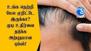 உங்க நெற்றி மேல ஏறிட்டே இருக்கா? முடி உதிர்வை தடுக்க அற்புதமான டிப்ஸ்! - Tamil TV