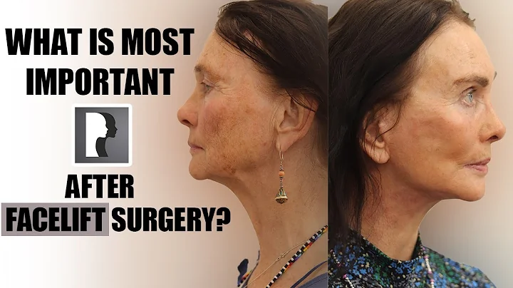 What are the most important things to do after a facelift surgery?
