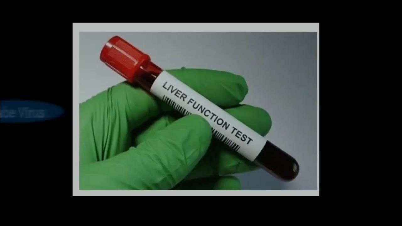 Liver Function Tests (LFT) lab test Explanation English YouTube