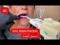 BITE REGISTRATION / تسجيل العضة (عربي وانجليزي)