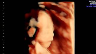 IMG 20150523 4 VolCine